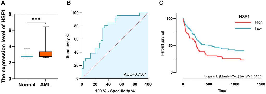 The expression level, diagnostic value and prognostic significance of HSF1 in AML based on data from gene expression omnibus (GEO). (A and B) The expression level and diagnostic value of HSF1 in AML based on data from GSE9476. (C) The prognostic significance of HSF1 based on data from GSE12417. ***P 