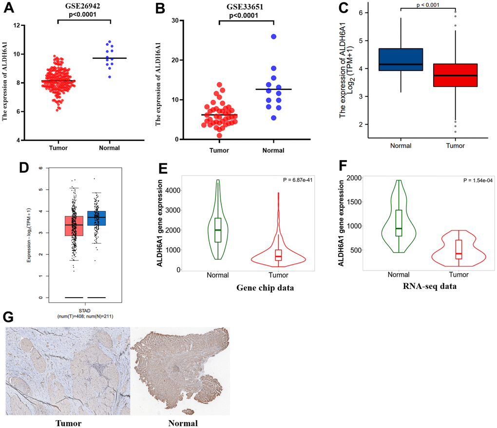 ALDH6A1 expression was lower in GC group than in normal group. (A, B) The expression levels of ALDH6A1 were lower in gastric cancer tissues when compared to normal gastric tissues. (C, D) Both the GEPIA2.0 platform and the TCGA platform showing ALDH6A1 expression was diminished in GC group. (E, F) The TNMplot platform has conveyed that ALDH6A1 expression decreased in GC group from RNA-seq data and gene chip data. (G) IHC analysis showed the ALDH6A1 expression was downregulated in GC tissues.