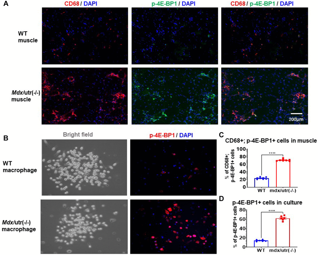 Macrophages in mdx/utro(−/−) muscle exhibits higher level of mTOR activation. (A) Immunofluorescent staining of CD68 and p-4E-BP1 in muscle tissues of WT and mdx/utro(−/−) mice. (B) Immunofluorescent staining of p-4E-BP1 in macrophages isolated from muscle tissues of WT and mdx/utro(−/−) mice. (C) Statistics of results in vivo. n = 8 mice/group. Data are presented as mean +/− SD. (D) Statistics of result in vitro, n = 6 (3 cell lineages x 2 replicates/group). Data are presented as mean +/− SD.