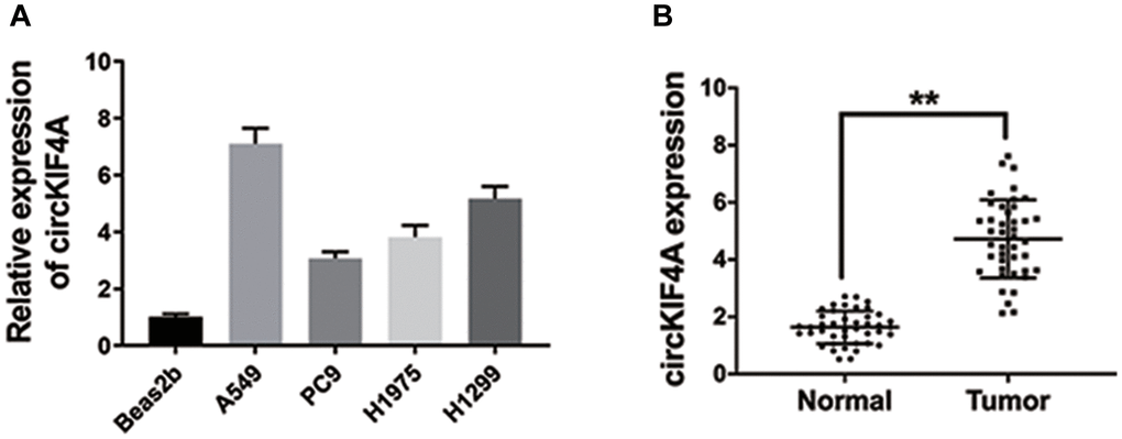 circKIF4A is upregulated in NSCLC. (A) The circKIF4A expression in NSCLC cell lines. (B) The expression of circKIF4A in 42 pairs of NSCLC tissues and adjacent normal tissues. **P 