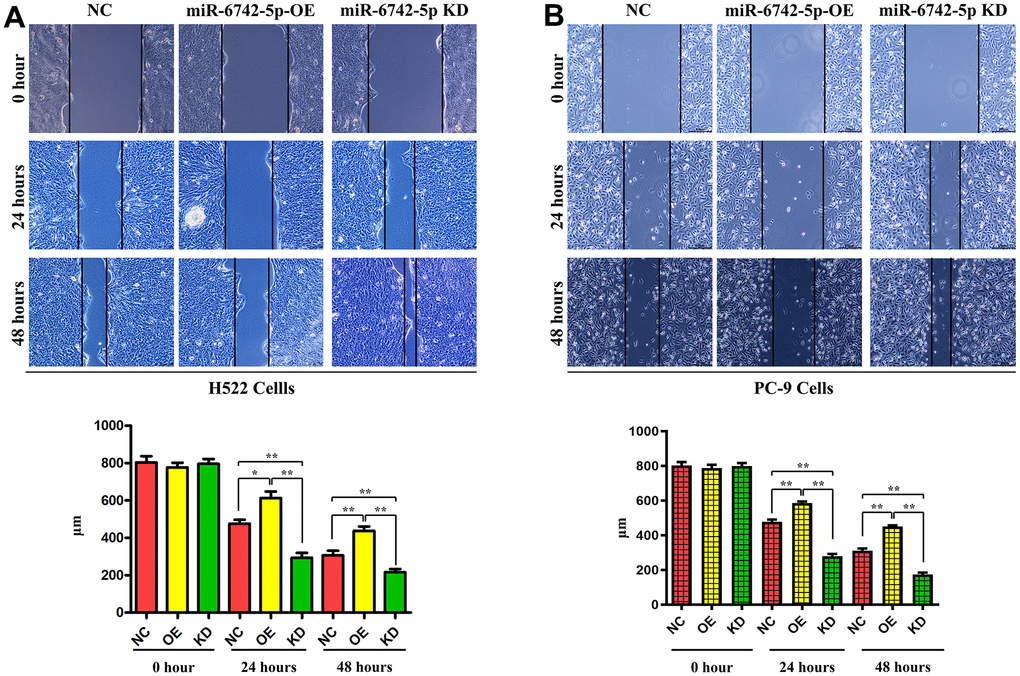 miR-6742-5p inhibited the migratory capability of LUAD cell. Wound healing assay showed that miR-6742 mimic (OE) significantly increased and miR-6742 inhibitor (KD) reduced wound closure and its quantifications in H522 Cells; (A) 24hours *P=0.0152miR-6742-5p OE group vs NC group;**P=0.0015miR-6742-5p KD group vs NC group; 48hours **P=0.0092 miR-6742-5p OE group vs NC group;*P=0.0281 miR-6742-5p KD group vs NC group (B) 24hours **P=0.0006miR-6742-5p OE group vs NC group;**P=0.0001miR-6742-5p KD group vs NC group; 48hours **P=0.0001 miR-6742-5p OE group vs NC group;**P=0.0002 miR-6742-5p KD group vs NC group.