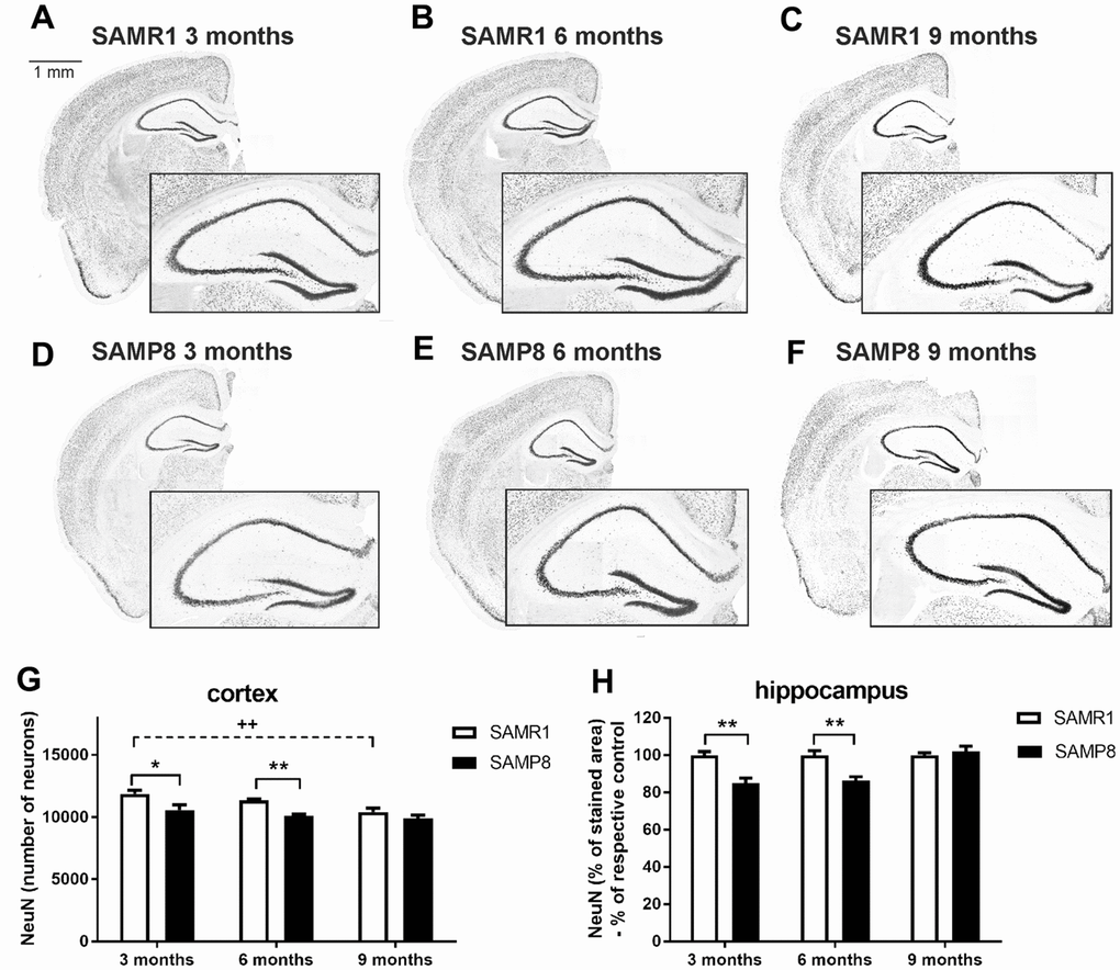 Decreased total number of neurons in the cortex and hippocampus of SAMP8 immunohistochemically stained for NeuN: representative photomicrographs of the brains of SAMR1 (A–C) and SAMP8 (D–F) mice. Black-framed inserts in right down corners show a magnified area of hippocampus, and (G, H) the quantification. Total number of stained particles was counted in cortex, percentage of the stained area expressed as a % of a respective control group was used in hippocampus. Data are mean ± SEM, analyzed by 2-way ANOVA with Bonferroni post test. Significance is *P 