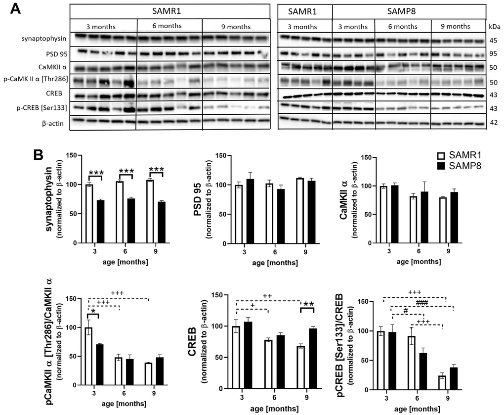 Decreased markers of synaptic plasticity in the hippocampi of SAMP8 (A) western blots and (B) their quantification. Data are mean ± SEM, analyzed by 2-way ANOVA with Bonferroni post test. Significance is *P 