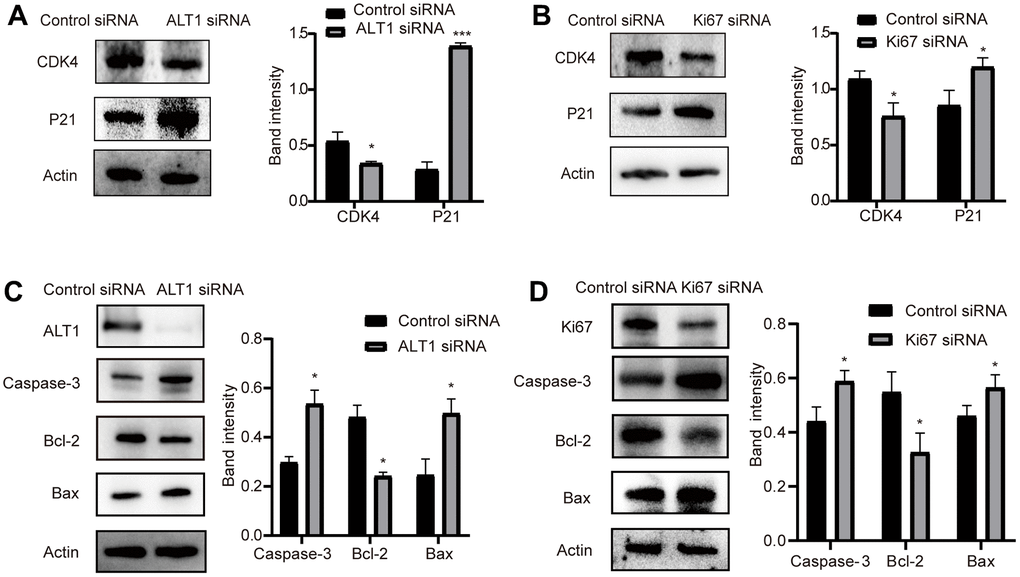 (A) Quantitative analysis results and representative images of the Western blot results for cleaved CDK4 and P21 in ALT1 knockdown HepG2 cells. (B) Quantitative analysis results and representative images of the Western blot results for cleaved CDK4 and P21 in Ki67 knockdown HepG2 cells. (C) Quantitative analysis results and representative images of the Western blot results for cleaved caspase-3, Bax, and Bcl-2 in ALT1 knockdown HepG2 cells. (D) Quantitative analysis results and representative images of the Western blot results for cleaved caspase-3, Bax, and Bcl-2 in Ki67 knockdown HepG2 cells.