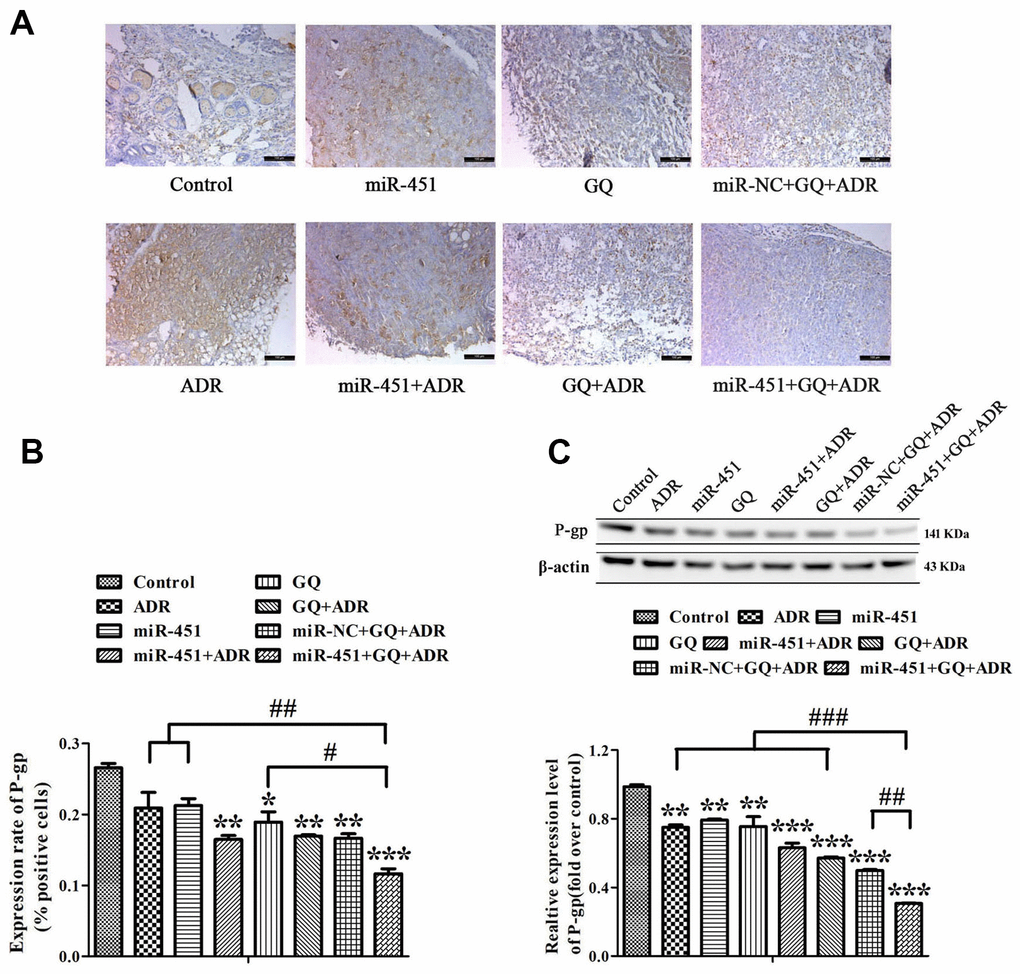 Effect of GQ and miRNA on the expression of P-gp in tumor tissues. (A) P-gp expression levels in tumor tissues were detected by IHC assay, the bar indicated 100 μm; (B) Quantitative analysis of the results in (A); (C) P-gp expression levels in tumor tissues were detected by western blot. All data represent the means ± SD of three independent experiments. *P **P ***P  0.001, comparing with control group. #P ##P ###P 