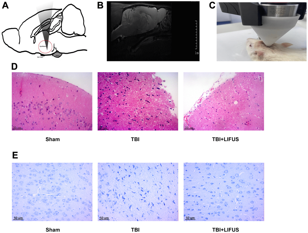 Low-intensity focused ultrasound (LIFUS) relieves tissue damage, neuronal degeneration and necrosis. (A) Schematic diagram of the relationship between ultrasonic path and rat brain anatomy. The inset shows a vertically incident ultrasonic beam. (B) A representative magnetic resonance imaging image of a rat brain. (C) LIFUS in rats. (D) Representative hematoxylin and eosin staining images of three groups of cortical tissues showing areas of necrosis, Scale=50 um. (E) Representative Nissl staining of three groups of cortical tissues demonstrates necrotic degeneration of neurons, Scale=50 um.