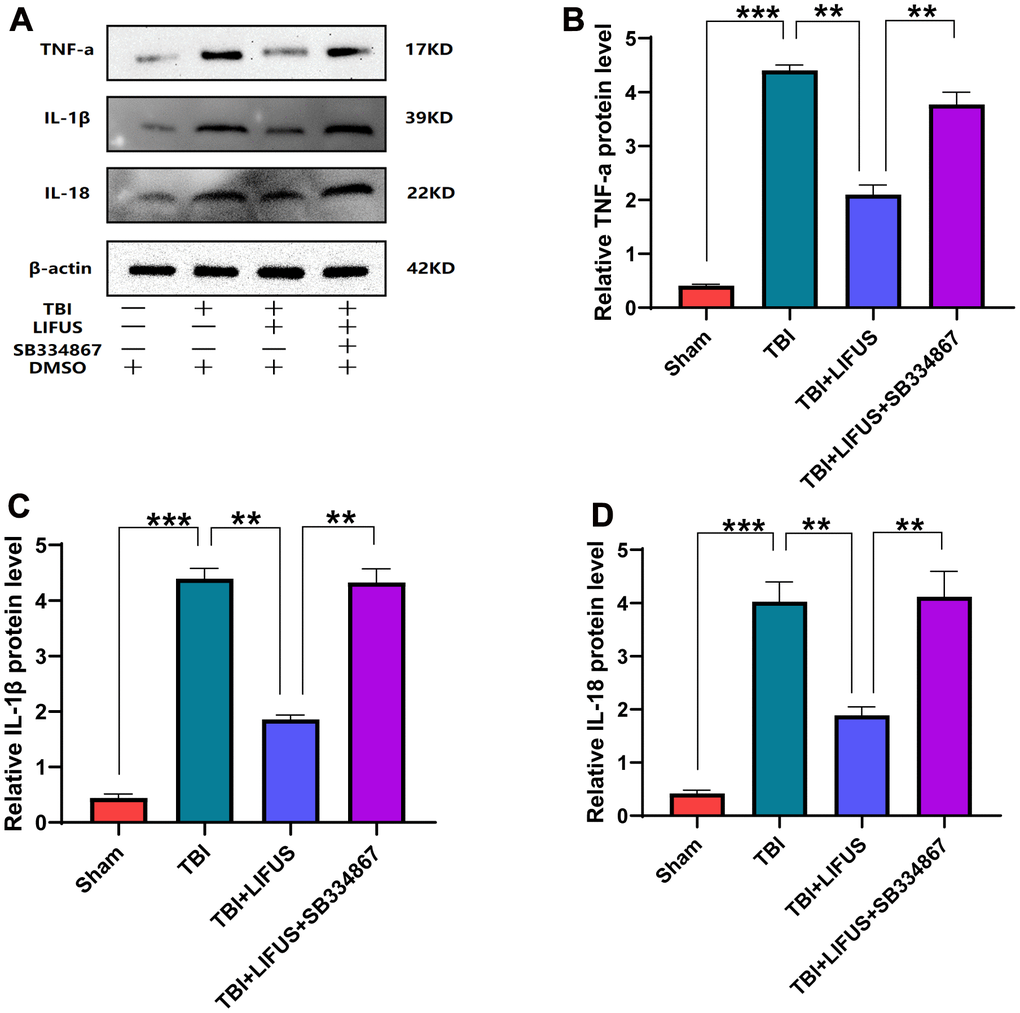 Low-intensity focused ultrasound (LIFUS) inhibited the levels of pro-inflammatory factors in traumatic brain injury (TBI) rat models by orexin-A (OX-A). (A) tumor necrosis factor-a (TNF-a), interleukin-1β (IL-1β), and interleukin-18 (IL-18) represent western blot protein bands, (B–D) are the gray values of TNF-a, IL-1β, and IL-18 bands, respectively, Results are expressed as mean±standard deviation (n=6, SD, *P