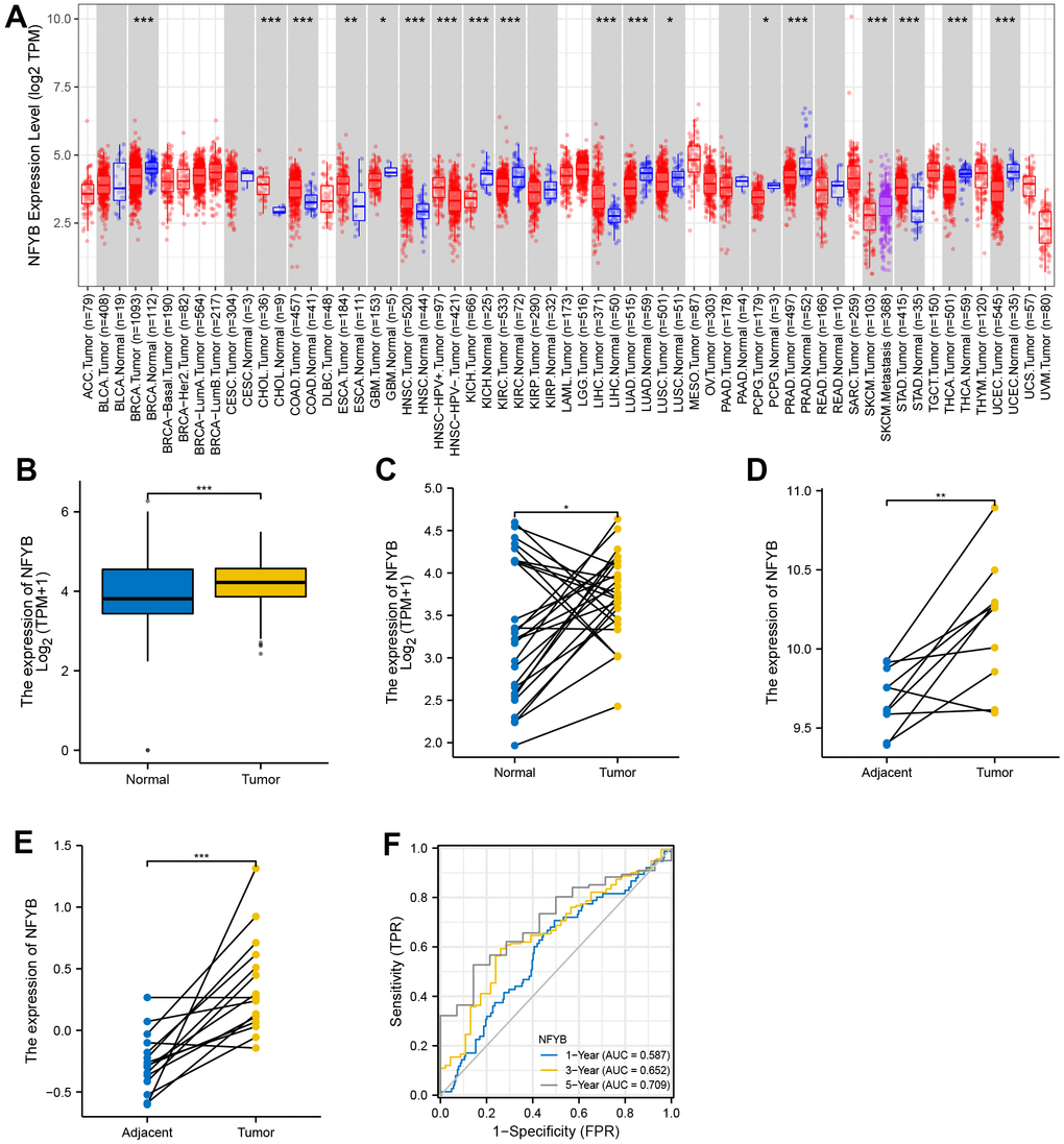 NFYB is highly expressed in gastric cancer tissues. (A) The expression of NFYB in pan-cancer of TCGA. (B) The expression of NFYB in non-paired GC and stomach tissue of TCGA and GETx. (C) The expression of NFYB in paired GC and adjacent normal tissue of TCGA. (D) The expression of NFYB in paired GC and adjacent normal tissue of GSE79973. (E) The expression of NFYB in paired GC and adjacent normal tissue of GSE118916. (F) The time dependence ROC curve analysis of NFYB.