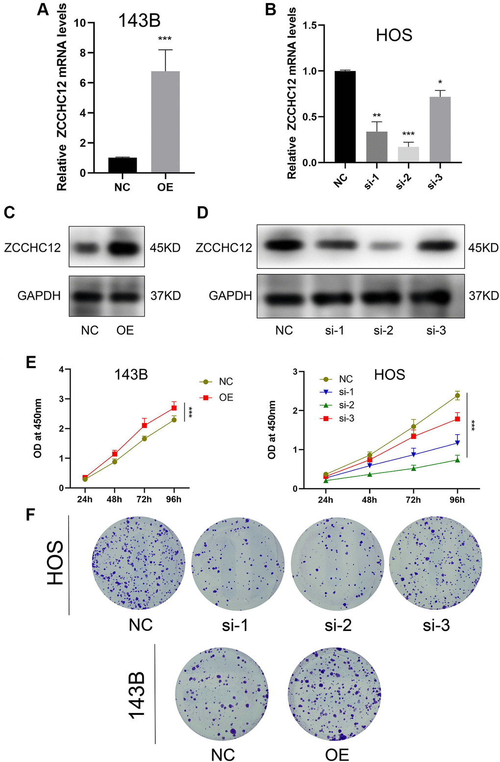 ZCCHC12 promoted OS cell proliferation. (A and B), qRT-PCR was applied to verify the overexpression and knockdown efficiency of ZCCHC12. (C and D), western blot analysis was performed to examine the expression of ZCCH12 in OS cells. (E) CCK8 analyses of the OS cell proliferation with ZCCHC12 overexpression or knockdown. (F) Colony formation assay analysis of cell proliferation after ZCCHC12 knockdown or overexpression in OS cells. n = 5; *P **P ***P 