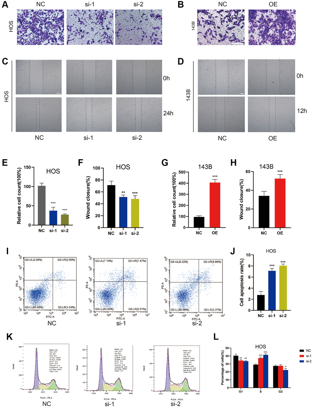 ZCCHC12 facilitated cell migration and inhibition of it induced cell apoptosis and S-phase arrest in OS cells. (A–D), migration ability of cells was detected by Transwell migration assays (A and B) and wound-healing assays (C and D). (E–H), the quantifications of cell migration were presented by the column chart. (I) Flow cytometry images of the cell apoptosis and (J) column bar graph of apoptotic cells. (K) Cell cycle in HOS cells with ZCCHC12 knockdown and (L) percentages of cells in each cell cycle phase are shown in the bar graph. scale bar: 200 μm. n = 5; *P **P ***P 