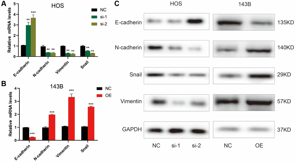 ZCCHC12 promoted OS cell EMT progression. (A–C), qRT-PCR (A and B) and western blot analysis (C) were performed to examine EMT-related markers in OS cells after ZCCHC12 knockdown or overexpression. n = 5; **P ***P 