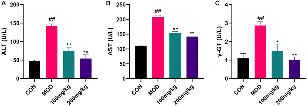 Changes of liver index induced by CPF in mice. Serum LEVELS of AST, ALT and γGT were measured with ALT, AST and γGT kits. (A) ALT levels in serum of mice. (B) Serum AST levels in mice. (C) Serum γGT level in mice. #p ##p *p **p 