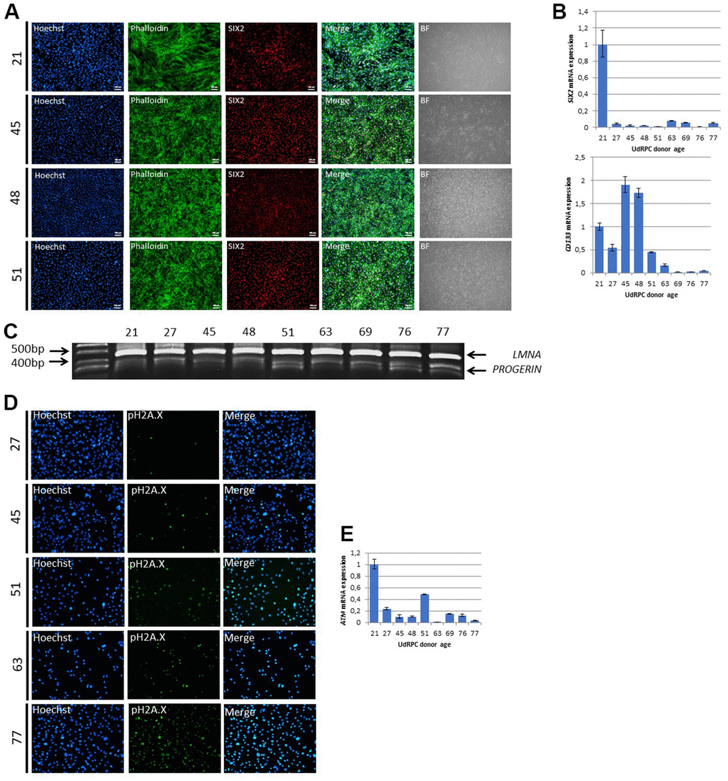 UdRPCs show decline of mesenchymal stem cell characteristics and an increase of DNA-damage with increase donor age. UdRPCs from donors aged between 21 and 77 years were isolated and stemness status was confirmed by immunofluorescent staining for the renal progenitor marker SIX2 (A) (scale bars: 100 μm). mRNA expression of SIX2 and the stem cell proliferation marker CD133 was determined by quantitative real time PCR (B). RT-PCR analysis reveal Progerin transcripts in UdRPCs (C). UdRPCs from donors aged between 21 and 77 years were isolated and DNA damage was visualized by immunofluorescence-based staining for phosphorylated Histone2A.X (pH2A.X) (D). mRNA expression of ATM was determined by quantitative real time PCR (E).