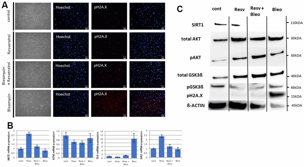DNA damage induces an aging phenotype by downregulation of SIRT1. Cell culture medium of UdRPCs was supplemented with 1μM of resveratrol and or 30 μg/ml of bleomycin for 24h. Phosphorylation of H2A.X was monitored by immunofluorescence-based expression analysis (A) (scale bars: 100 μm). mRNA expression of SIRT1, ATM, P16 and SIX2 was determined by quantitative real time PCR (B). Relative protein expression normalized to ß-ACTIN for SIRT1, AKT and GSK3ß and relative protein phosphorylation for AKT, GSK3β and pH2A.X was detected by Western blotting (C).