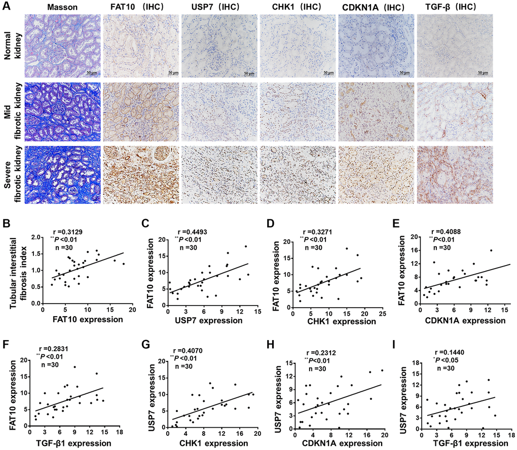 FAT10 was up-regulated and positively correlated with renal fibrosis in patients with calculi related chronic kidney disease. (A) Representative photos of renal sections from normal kidney and biopsy samples from patients with calculi related chronic kidney disease. IHC, immunohistochemistry; scale bar = 50 μm. (B) The expression of renal FAT10 at initial biopsy positively correlated with the tubular interstitial fibrosis index in a partial correlation analysis. (C–F) Scatter plots show a positive correlation between FAT10 and USP7, CHK1, CDKN1A, TGF-β, respectively. (G–I) The statistical analysis data show that the expression level of USP7 was positively correlated with the expression level of CHK1, CDKN1A and TGF-β. *P **P 