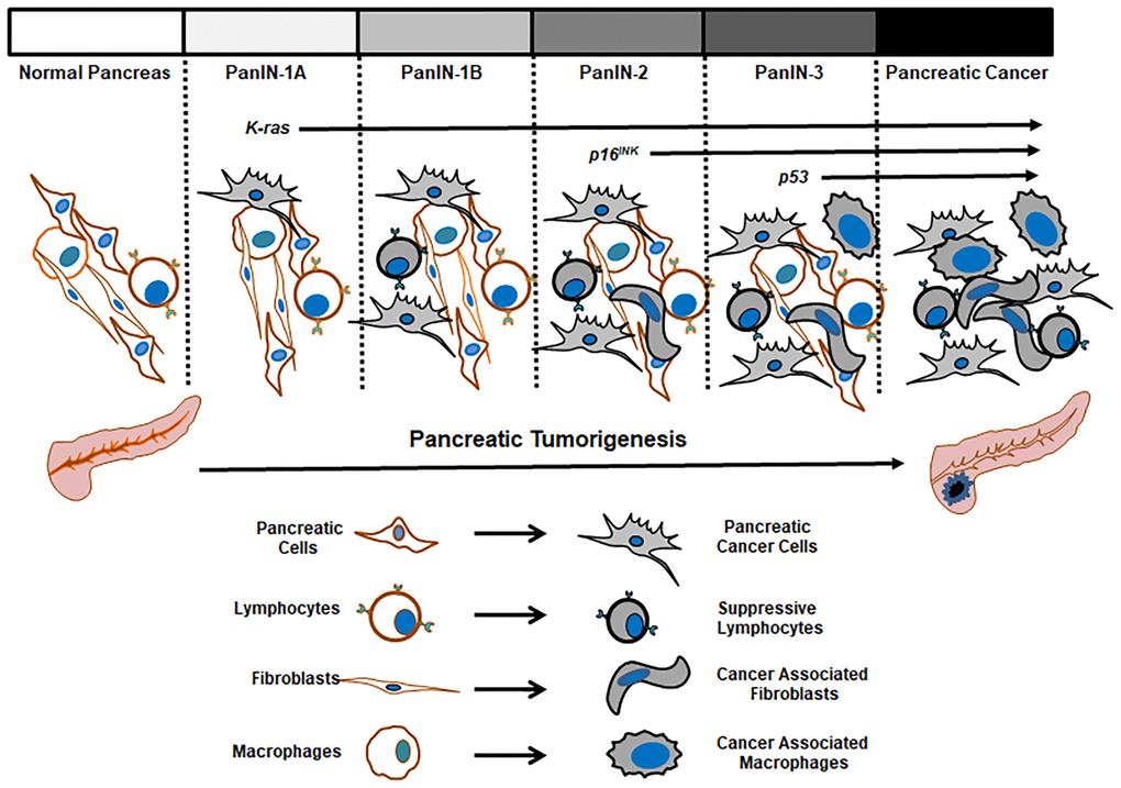 Pathological changes in the progression of pancreatic tumors.