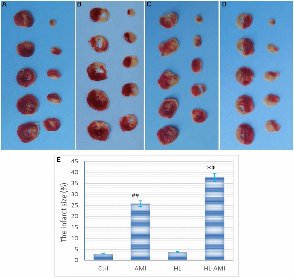 Myocardial ischemic area in the 4th subgroup rats of each group. (A–D) (represents the Ctrl, HL, AMI, and HL-AMI group, respectively), Photos of myocardial sections stained by TTC, viable tissue was stained red and infarct area was pale and unstained; (E) Diagram of the myocardial infarction rate of the four groups. MI infarct size was expressed as the percentage of the infarct area relative to the whole myocardium. **, ##, P n = 8 animals in each group), and vertical lines indicate the SEM.