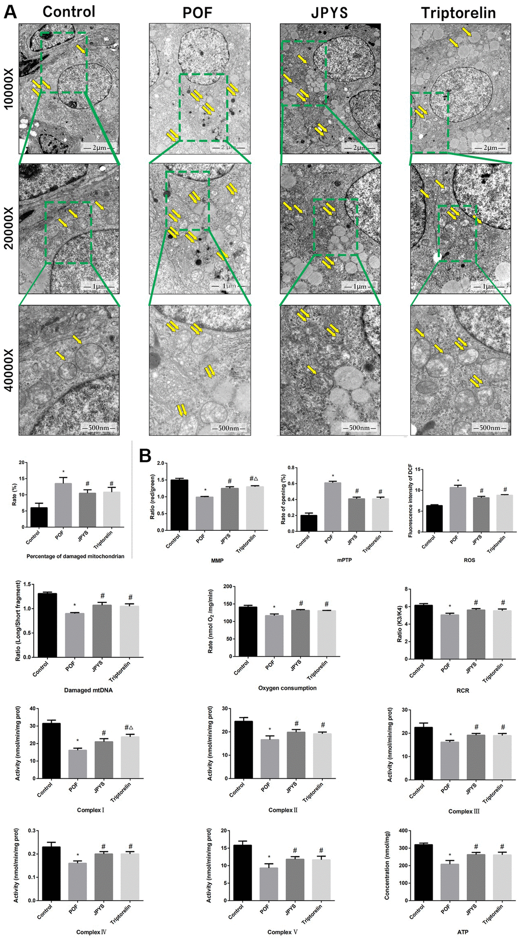 JPYS improved mitochondrial function in premature ovarian failure (POF) rats. Rats were treated with JPYS (11.0 g/kg.d) and pre-treated with triptorelin (1.5 mg/kg) followed by intraperitoneally injected cyclophosphamide (50 mg/kg). (A) Electron microscope pictures (10,000×; 20,000×; 40 000×) of ovary in POF rats, the scale bars represents a length of 2 μm, 1 μm, and 500 nm on histology respectively. Abnormal mitochondrial (paired yellow arrow) morphology show that mitochondrial membrane rupture or swellings, normal mitochondrial (single yellow arrow) morphology type show that mitochondrial membrane smooth and inner carinulae distinct and percentage of damaged mitochondria; (B) The MMP (ratio of red/green), the opening of mPTP (%), the mitochondrial ROS, the mtDNA damage (ratio of long/short fragments), the mitochondrial RCR, mitochondrial oxygen consumption rate, the mitochondrial respiratory chain complex enzymes (I, II, III, IV, and V), and ATP were recorded above. Data are shown as mean ± SD. *p #p △p 