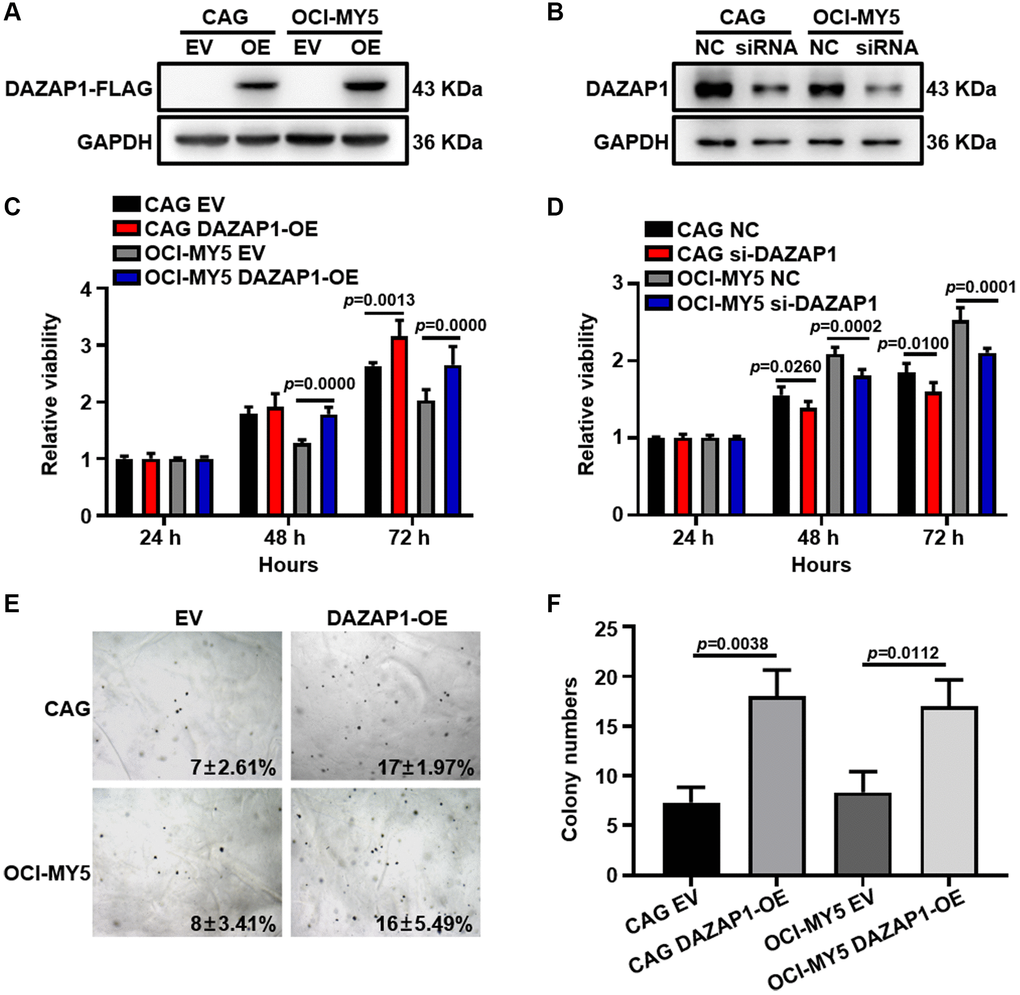 Overexpression of DAZAP1 enhances the proliferative capacity of MM cells in vitro. (A and B) DAZAP1 expression in DAZAP1-OE and siDAZAP1 MM cells were examined by WB analysis. (C and D) The proliferation rate of DAZAP1-OE and siDAZAP1 MM cells was assessed by CCK8 assay. (E) Soft agar colony formation assay revealed overexpressed DAZAP1 accelerating colony formation. (F) The histogram showed quantification of colony formation in soft agar. All data management and analysis were done using the GraphPad Prism 8.0 version. The P value was calculated with Student’s t-test, (*p **p ***p 