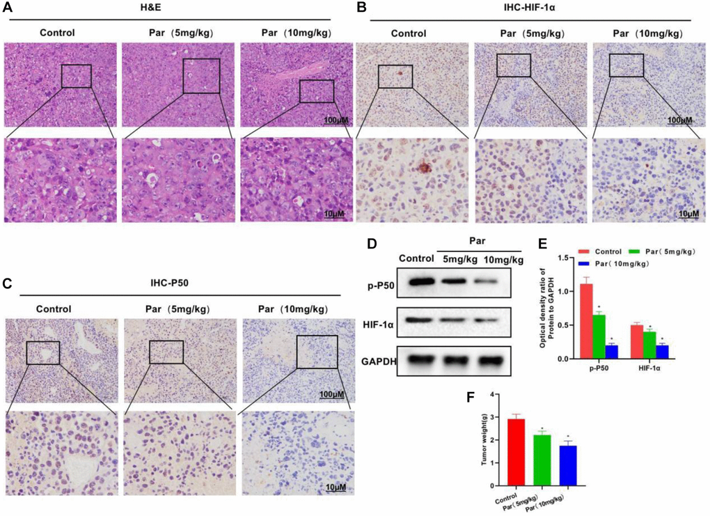 Par inhibits the tumor growth. (A) H&E staining revealed an impotent killing activity of Par against tumor tissues, without producing obvious tissue inflammation or evident toxic effect. (B–E) In the IHC staining and Western-Blot assays, Par inhibited the tissue expressions of P50 and HIF-1α in a dose-dependent manner. *P F) In the tumor mass detection, Par could inhibit the growth of tumor, significantly reducing the tumor mass. *P 