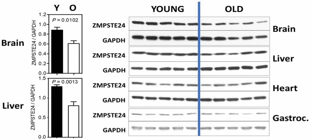 ZMPSTE24 protein expression during murine aging. ZMPSTE24 protein levels were determined by Western blots from brain, liver, heart, gastrocnemius, and subcutaneous fat of young (9 months of age, n = 5) and old (22 months of age, n = 5) female mice. Relative ZMPSTE24 levels (normalized to GAPDH) were quantified by densitometry using ImageJ software (http://rsb.info.nih.gov/ij/). All bars represent mean ± SEM. The statistical significance of differences between two groups (as indicated with P values) was determined using unpaired, two-tailed Student’s t-test. The antibody used was a Rabbit polyclonal to ZMPSTE24 from Abcam; Catalog number ab38450.