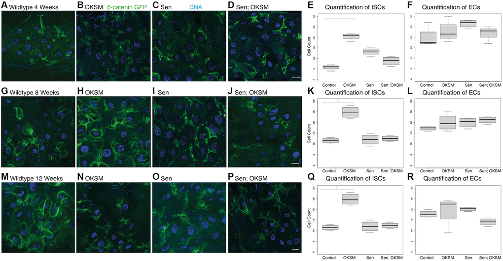 Cycling OKSM expression maintains a larger pool of intestinal stem cells over time. We visualized and quantified stem cells using β-catenin-GFP (armGFSTF) which appeared enriched in ISCs. Flies cycled expression through temperature shifts from 18° to 25° for twelve hours twice per week. (A) armGFSTF; armGal4; tubGal80ts > UAS-TdTomato control flies showed a small number of stem cells and few enteroblasts after four weeks. Expression of OKSM (B), Sen (C) or both Sen and OKSM (D) led to an increase in both ISCs with the highest number of ISCs observed in the OKSM condition as quantified (E, F). After eight weeks, the number of ISCs in the OKSM condition was much higher in the OKSM flies as compared to wildtype (G, H) and Sen (I) or Sen; OKSM (J) quantified (K, L). At twelve weeks, OKSM flies maintained high numbers of stem cells while the other conditions (M–P) showed fewer as quantified (Q, R).