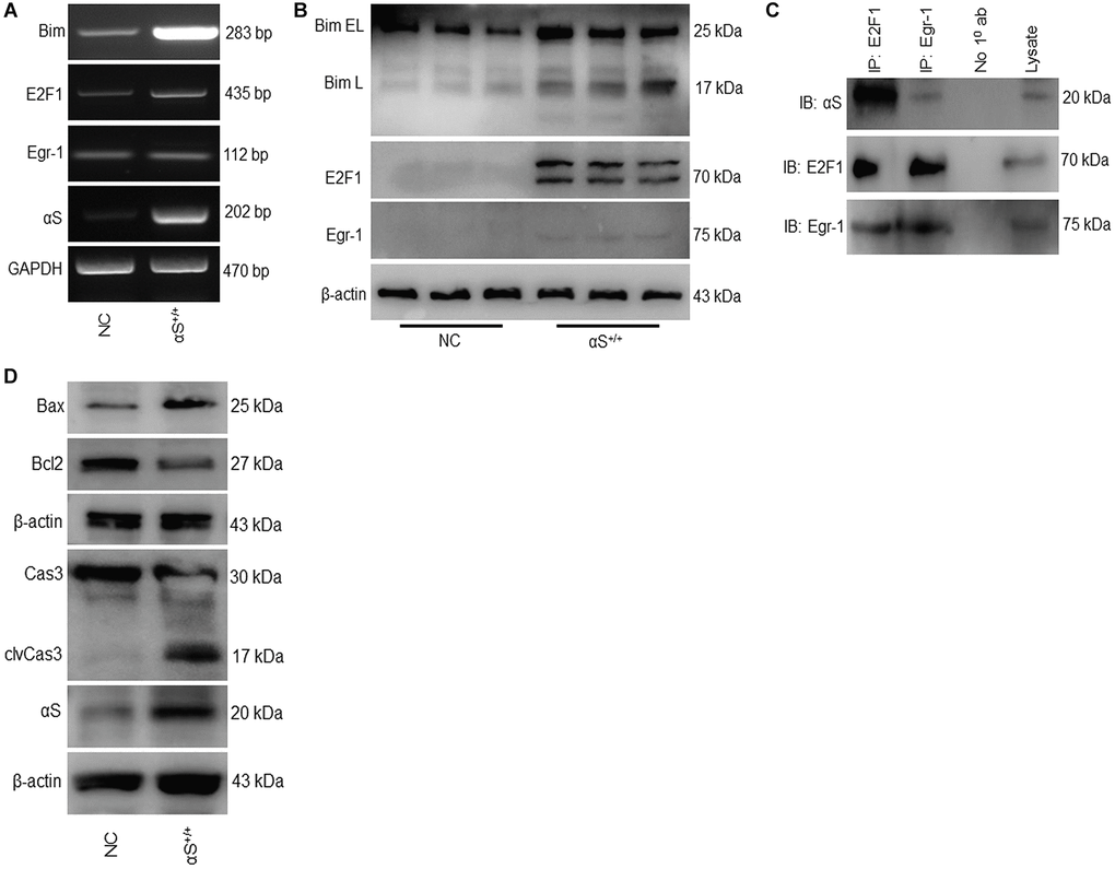 Overexpression of αS promotes Bim-mediated apoptotic pathway. (A) mRNA and (B) protein expression of Bim and its transcription factors in non-transfected cells (NC) and transfected (αS+/+) cells. (C) SH-SY5Y cells were co-immunoprecipitated by anti-E2F1 and anti-Egr1 or A/G beads only (No 10 ab) as negative control and probed for anti-αS. (D) Protein expression of apoptotic markers.