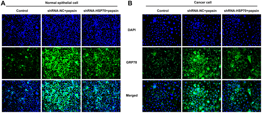 HSP70 silencing decreased the expression of GRP78 in pepsin-stimulated laryngeal epithelial cells and LC cells. (A and B) IF assay was used to detect the expression of ERS-related protein GRP78 in laryngeal epithelial cells and LC cells.