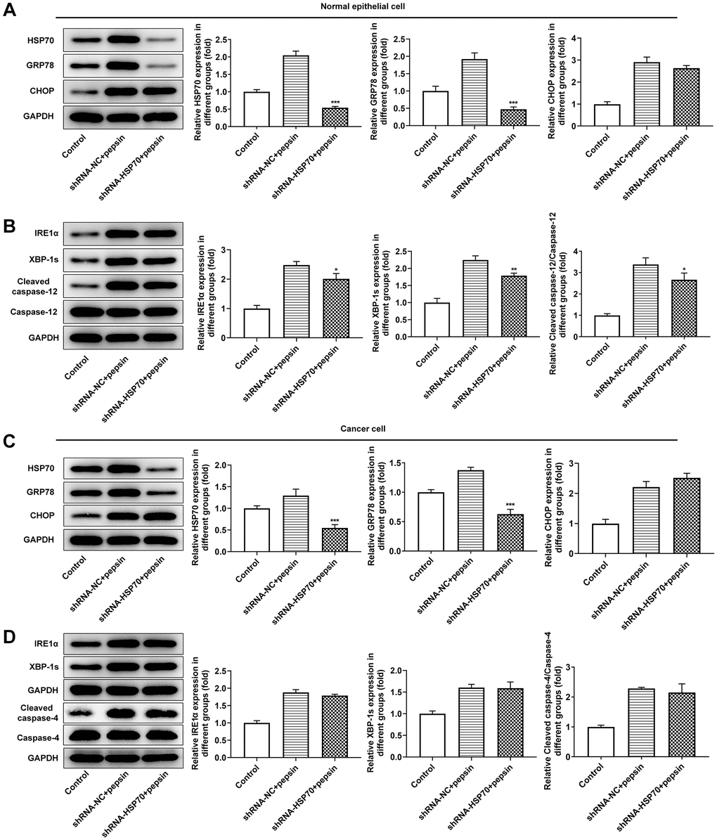 Inhibition of HSP70 only inhibited downstream apoptosis-related pathways in laryngeal epithelial cells instead of in LC cells. (A and B) Western blot detected the expression of ERS-related proteins in laryngeal epithelial cells. (C and D) Western blot detected the expression of ERS-related proteins in LC cells. *p **p ***p 