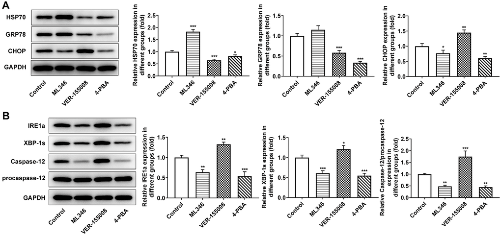 The effect of inhibition of HSP70 and ERS on ERS-related proteins in tumor-bearing mice. (A and B) Western blot detected the expression of ERS-related proteins. *p **p ***p 