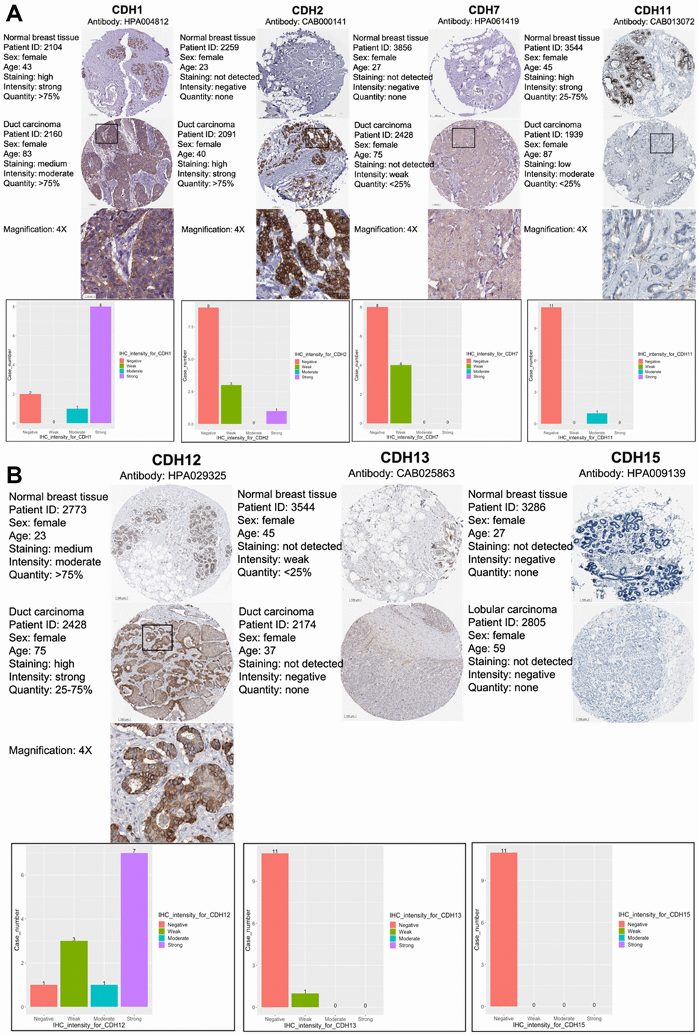 Protein expression levels of members of cadherin (CDH) family genes in all clinical breast cancer specimens from the Human Protein Atlas (HPA). (A) Images of immunohistochemistry (IHC) of CDH1/2/7/11 show their staining intensities. IHC images and patients’ information were obtained from the HPA. Normal and tumor samples are listed, and bar charts represent the quantification of IHC staining in breast cancer samples. There were strong intensities of CDH1 and CDH2 in breast cancer samples. (B) IHC images of CDH12/13/15 show their staining intensities. IHC images and patient information were obtained from the HPA. Normal and tumor samples are listed, and bar charts present quantification of IHC staining in breast cancer samples. There were strong intensities of CDH12 in breast cancer samples.