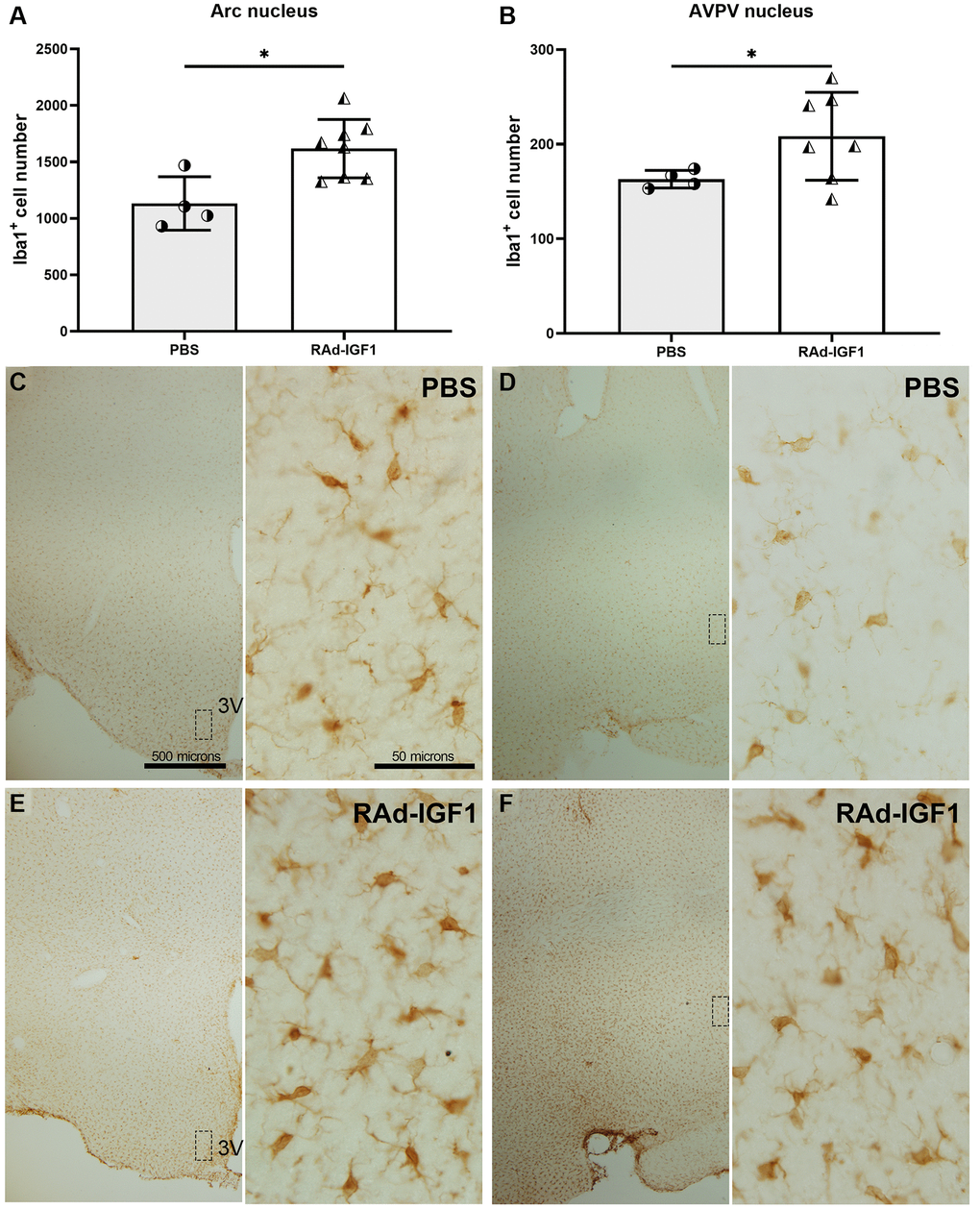 IGF1 gene therapy effect on the Iba1 immunopositive cells. (A and B) Quantification of Iba1 immunopositive cells. Error bars represent SD (Arcuate: NRAd-IGF1 = 8; NPBS = 4. AVPV: NRAd-IGF1 = 7; NPBS = 4). t test with Welch’s correction was used. Asterisks indicate significant (*p Figure 6A post hoc power (1-β) analysis: 0.8211; Figure 6B post hoc power (1-β) analysis: 0.4876. (C–F) Immunohistochemistry for Iba1 of control (PBS) and experimental (RAd-IGF1) rat’s brain slides at a magnification of 40× (scale bars: 500 microns), with insets at a magnification of 600× (scale bars: 50 microns). Abbreviation: 3V: third ventricle.