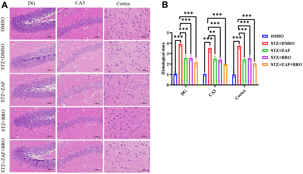 H&E stain of brain tissues of mice treated with NLRP3 inhibitor and Golph3 inhibitor. (A) H&E stain of cortex and hippocampus of mice in DMSO, STZ + DMSO, STZ + ZAF, STZ + BRO, STZ + ZAF + BRO treated groups. (B) Histological score of cortex and hippocampus of mice in of mice in DMSO, STZ + DMSO, STZ + ZAF, STZ + BRO, STZ + ZAF + BRO groups. All data are presented as means ± SEM (n = 8/group). Bar=50μm. * p p 