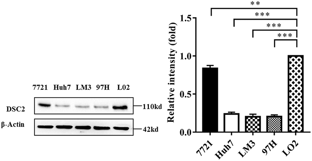 DSC2 expression in HCC cell lines. DSC2 expression levels in L02 and HCC cell strains were detected by Western blot analysis (repeated three times). *P **P ***P 