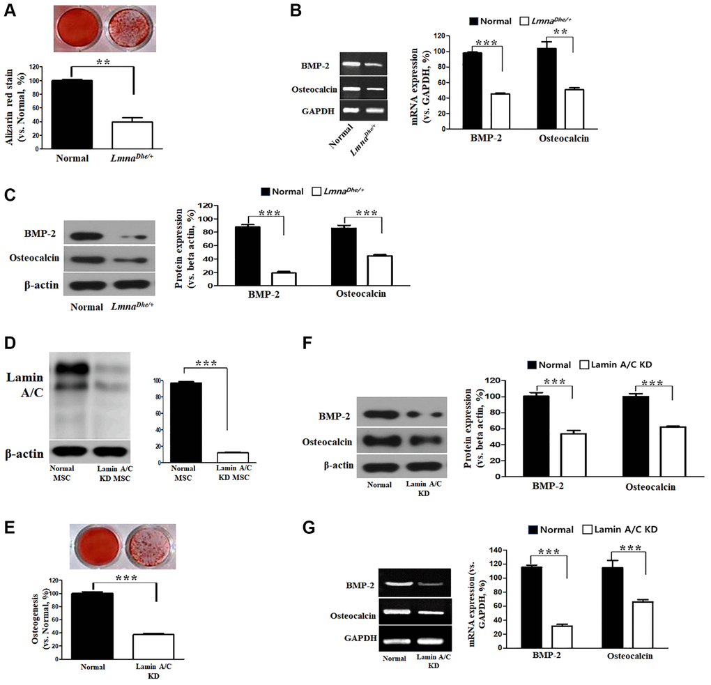 Osteogenic analysis in Lmna dysfunction MSCs compared to normal MSCs. (A) Alizarin Red staining. (B) Expression of osteogenic genes in Lmna dysfunction MSCs compared with normal MSCs. (C) Expression of osteogenic proteins in Lmna dysfunction MSCs compared with normal MSCs. (D) Lamin A/C knock down by siRNA. and (E) Alizarin Red staining. (F) Expression of osteogenic proteins in Lmna dysfunction MSCs compared with normal MSCs. (G) Expression of osteogenic genes in Lmna dysfunction MSCs compared with normal MSCs. ***p 