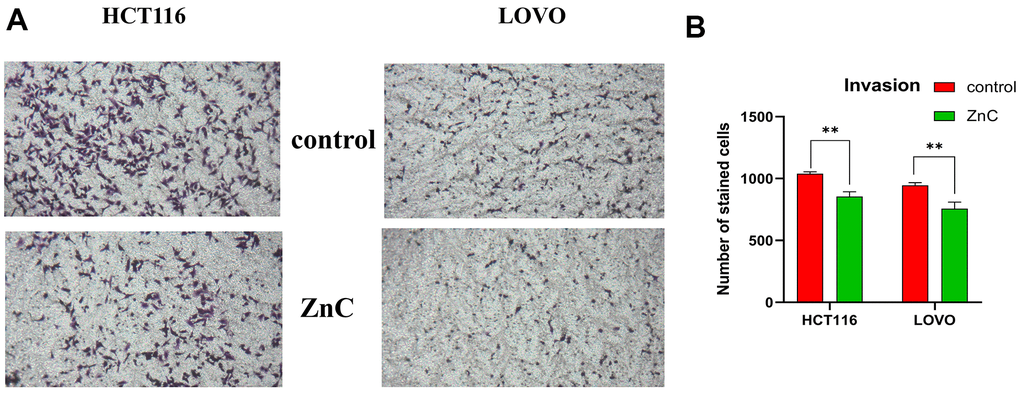 ZnC inhibited the invasion in CRC. (A) Transwell experiment was adopted to assess cell invasion of CRC cells incubated with ZnC. (B) Results of the cell invasion count analysis. **p 