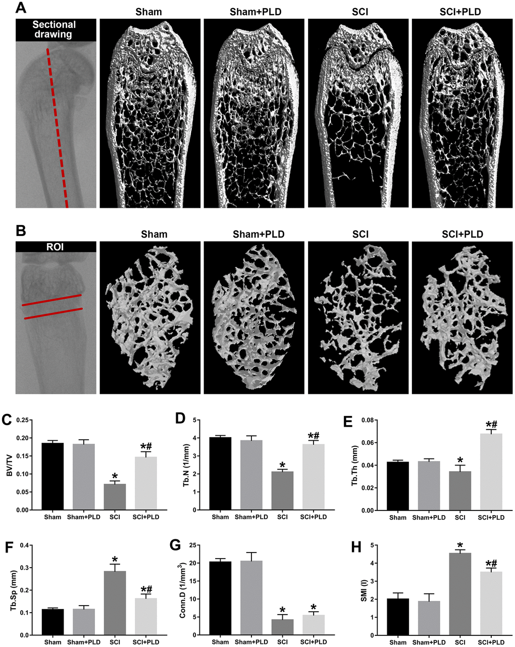 Effects of PLD on trabecular bone structure of the distal femur. (A) The schematic diagram of the coronal section of femur and representative 3D reconstructed coronal images of cancellous bone in the distal femur of each group. (B) The schematic diagram of the ROI of distal femur and the representative μCT 3D-images of cancellous bone within the ROI. Plots of the structural parameters: (C) BV/TV, (D) Tb.N, (E) Tb.Th, (F) Tb.Sp, (G) Conn.D, and (H) SMI. Data are expressed as mean ± S.D.; n=4 to 5 per group; *P P 