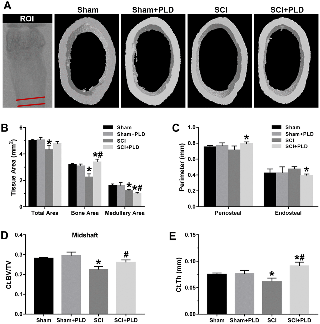 Effects of PLD on the cortical bone structure of femur midshaft. (A) The schematic diagram of the ROI of femoral midshaft and typical μCT images of cortical microarchitecture are displayed. Measurements are shown for (B) total, bone, and medullary tissue area, (C) periosteal and endosteal perimeters, (D) Ct.BV/TV and (E) Ct.Th. Data are expressed as mean ± S.D.; n=4 to 5 per group; *P P 