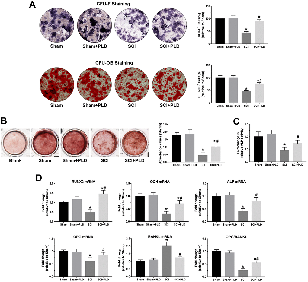 PLD promoted osteoblastogenesis in bone marrow progenitor cells generated from chronic SCI mice. (A) The number of osteoblast-like cells (CFU-F) and the number of mineralized nodules (CFU-OB) in BMSC cultures were identified by ALP staining and von Kossa staining, respectively. (B) Alizarin red staining was used to evaluate BMSC calcification in the presence or absence of OIM of in groups. (C) Quantitative analysis of the ALP activity assay. (D) RUNX2, OCN, ALP, OPG and RANKL mRNA levels, and OPG/RANKL ratio in the osteoblast-like cells. mRNA levels were determined by qRT-PCR analysis. Data are expressed as mean ± S.D.; n=4 per group; *P P 