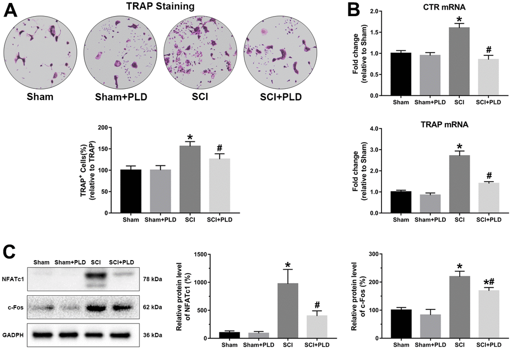 PLD inhibited the osteoclastogenic potential of bone marrow precursors isolated from chronic SCI mice. (A) The number of osteoclasts were identified by TRAP staining. (B) CTR and TRAP mRNA levels in cultured bone marrow progenitor cells. mRNA levels were determined by qRT-PCR analysis. (C) NFATc1 and c-Fos protein expression was detected by Western blotting and adjusted as relative values to GAPDH. Data are expressed as mean ± S.D.; n=4 per group; *P P 