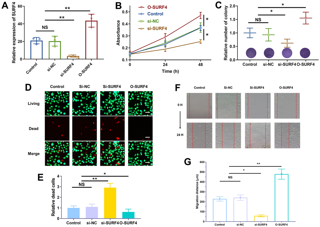 SURF4 promoted cell proliferation and migration of breast cancer cell 4T1. (A) Efficiency of plasmid transfection by qRT-PCR. (B) The cell viability by CCK8 assay. (C) Cell proliferation ability by colony formation assay. (D, E) Cell proliferation ability by living/dead staining assay. Scale bar = 50 μm. (F, G) Cell migration ability by wound healing assay. The experiments were repeated for 3 times. 40 x under light microscopy. NS, no significance; *P 