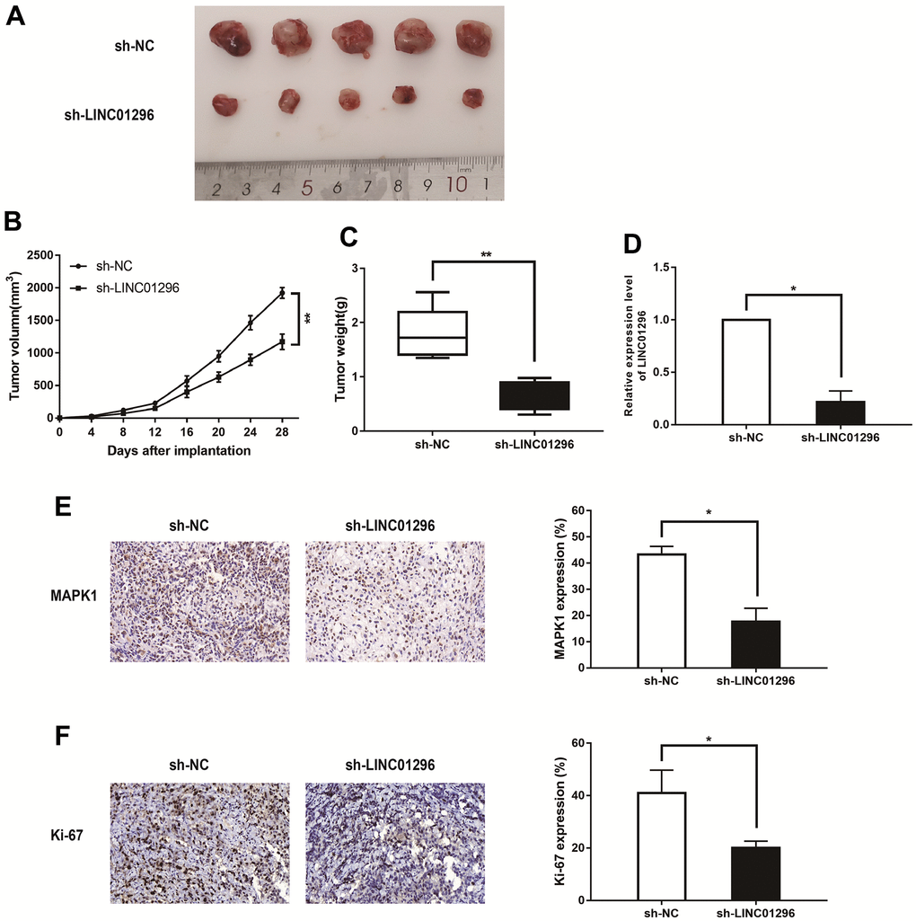 Decreasing LINC01296 contributed to suppress tumorigenesis in vivo. (A) Representative images of the xenograft tumors in subcutaneous xenograft mouse model injected with M21 cells transfected with sh-NC and sh-LINC01296. (B) Tumor volume of the xenograft in each group. (C) Tumor weight of the xenograft in each group. (D) The relative expression level of LINC01296 determined by qRT-PCR analysis following transfecting with sh-NC and sh-LINC01296. (E) The tumor sections from different transfected groups of xenograft mouse models were subjected to immunohistochemistry staining using antibodies against MAPK1 (400×). (F) The tumor sections from different transfected groups of xenograft mouse models were subjected to immunohistochemistry staining using antibodies against ki-67 (400×) All of data were analyzed from three independent experiments. * P P 