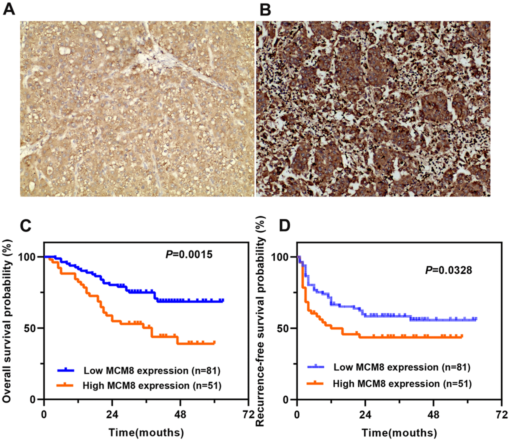 Prognostic value of MCM8 protein expression in a cohort of 132 HCC patients. (A, B) Representative images of low (A) and high (B) MCM8 protein expression in HCC tissues by IHC staining (×200 magnification). (C, D) Patients with higher MCM8 protein expression have poorer OS (C) and RFS (D).