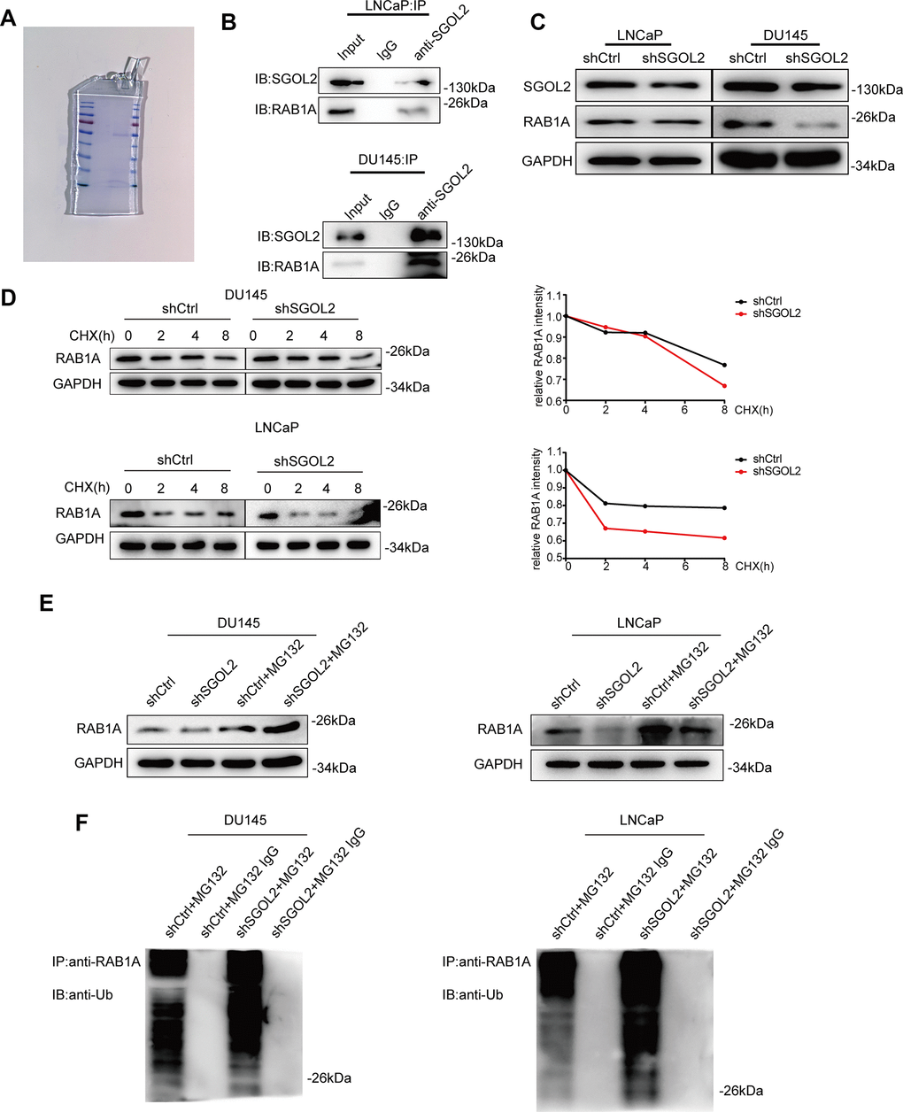 SGOL2 stabilized RAB1A via a ubiquitination-dependent pathway. (A) SDS-PAGE of the control group (left) and shSGOL2 group (right) was stained by Coomassie Blue Staining Solution. (B) Cell lysates were subjected to Co-IP with specific antibodies to examine the interaction between SGOL2 and RAB1A. (C) Detect RAB1A expression as in A in DU145 and LNCaP. (D) At 48h post-infection, WB analysis of RAB1A expression in shSGOL2 cell lines treated with CHX for 0, 2, 4, 8h compared to the control group. (E) Treated with protease inhibitor MG132 for 8h, cells were lysed and subjected to WB for RAB1A expression. (F) WB analysis for IPs performed with anti-ubiquitin antibody to detect SGOL2-mediated RAB1A ubiquitination.