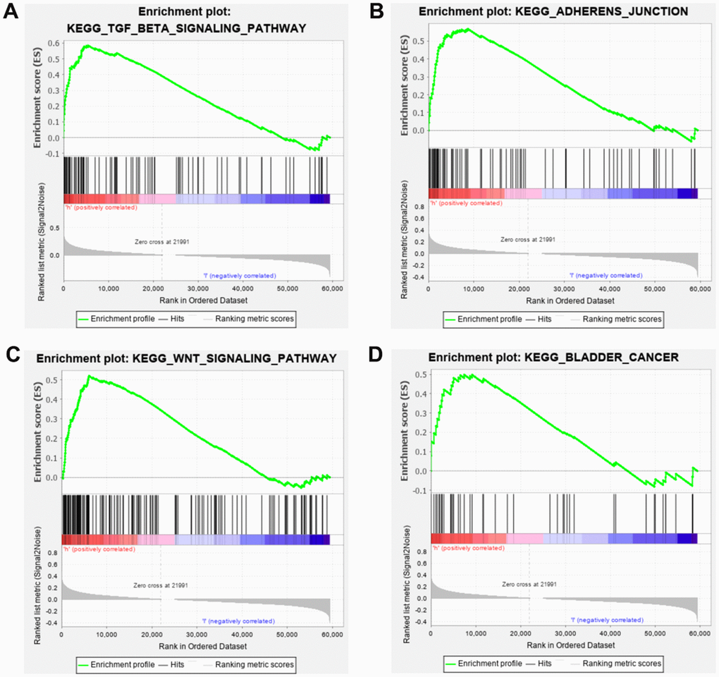 Gene set enrichment analysis (GSEA) of SRRSM. GESA illustrated that the high-risk group patients were significantly enriched in TGF-beta (A), adherens junction (B), WNT (C) and bladder cancer pathway (D).