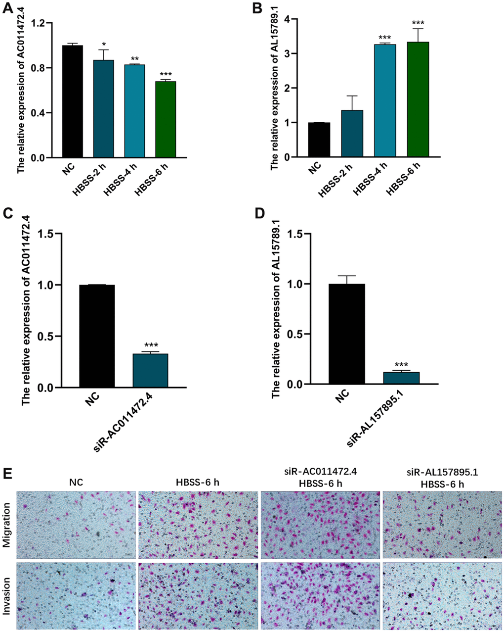 The effects of AC011472.4 and AL157895.1 on invasion and migration under starvation condition. The expression level of AC011472.4 (A) decreased under starvation condition, but AL157895.1 (B) increased. The knock-down efficiency of AC011472.4 (C) and AL157895.1 (D). Transwell assays showed the migration and invasion abilities of BCa cells following different treatments (E).