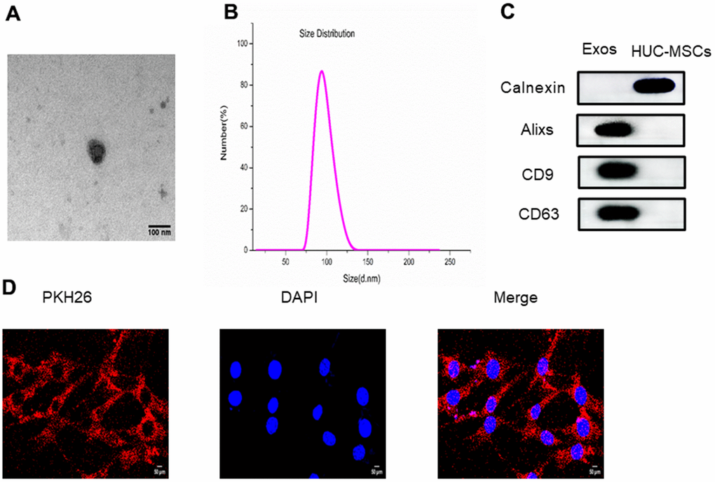 (A) The size and morphology of exosomes derived from HUC-MSCs were determined using transmission electron microscopy (TEM). (B) The size distribution of exosomes derived from HUC-MSCs was scattered and identified using DLS. (C) The surface biomarkers Alixs, CD9 and CD63 were detected using western blot to identify exosomes derived from HUC-MSCs. (D) The exosomes derived from HUC-MSCs were labeled with PKH26.