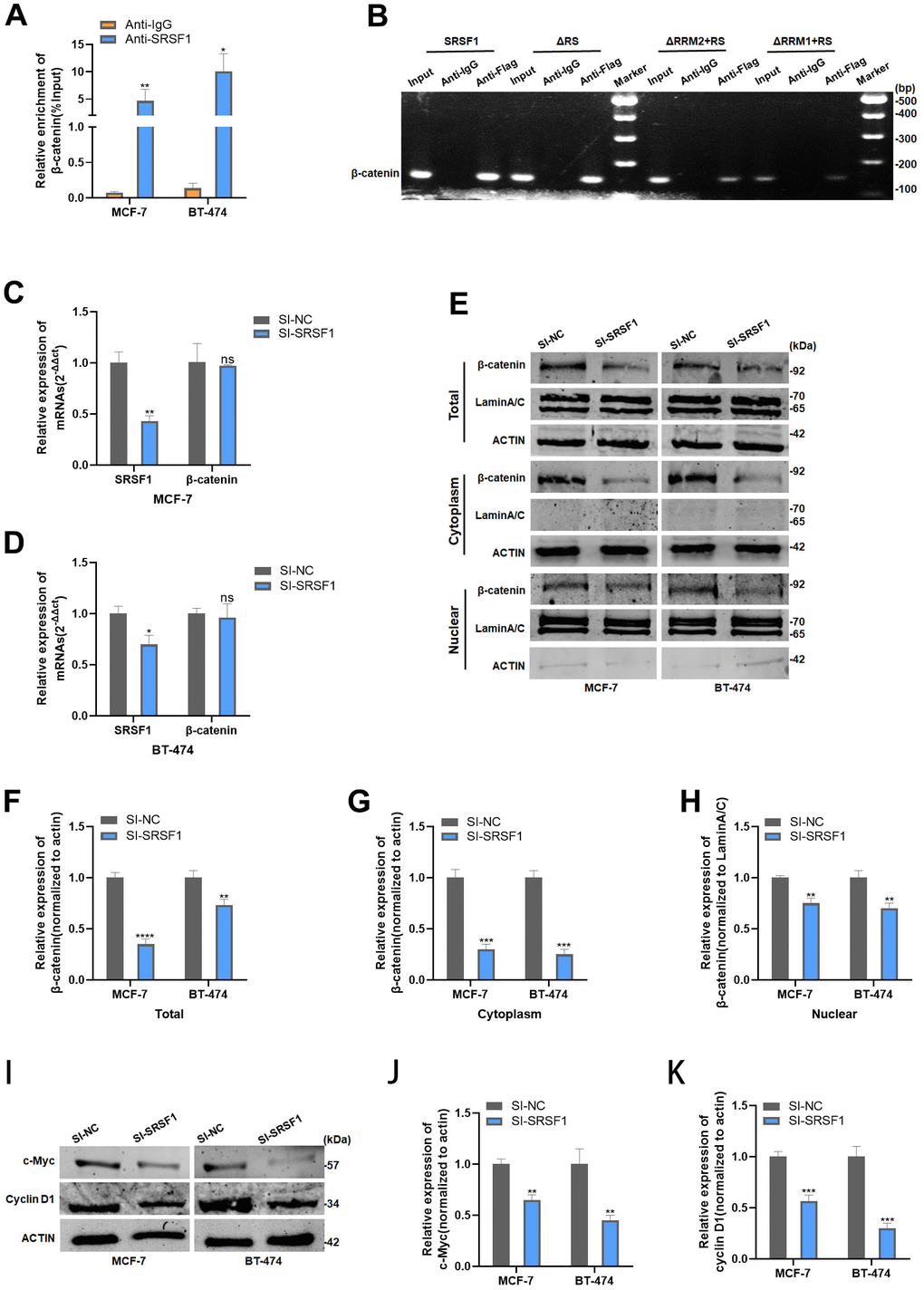SRSF1 promoted Wnt signaling via upregulating β-catenin expression. (A) Anti-SRSF1 RIP assay was applied to validate the binding of SRSF1 to β-catenin mRNA. (B) Anti-Flag RIP assay was applied to validate the binding of SRSF1 to β-catenin mRNA. (C, D) mRNA level of β-catenin in MCF-7 and BT-474 cell line transfected with SI-SRSF1. (E–H) Protein level of β-catenin in MCF-7 and BT-474 cell line transfected with SI-SRSF1. (I–K) Protein level of c-Myc and cyclin D1 in MCF-7 and BT-474 cell line transfected with SI-SRSF1. *p0.05.