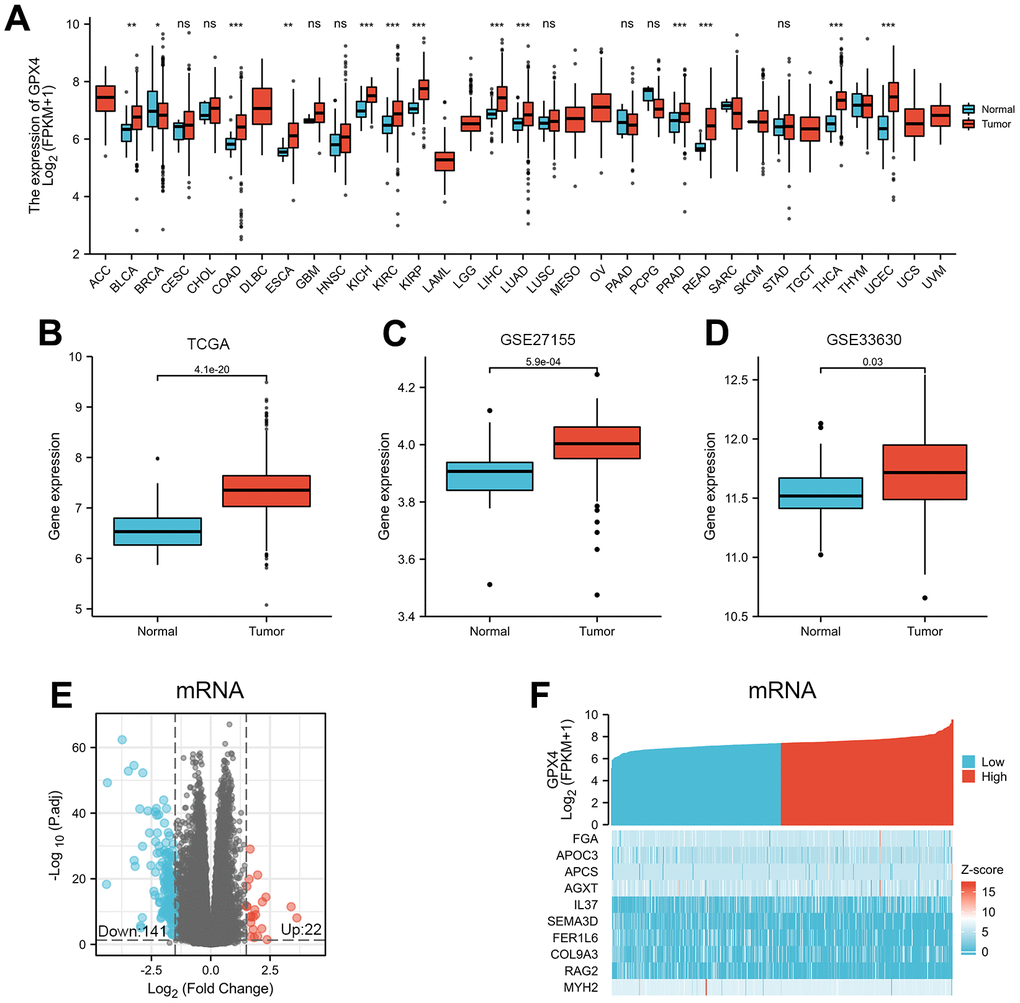 Differential mRNA expression profiles in thyroid cancer patients stratified by GPX4 level. (A) Comparison of GPX4 expression between different types of cancers and adjacent tissues based on TCGA. ns indicates p≥0.05, *pppB) as well as GSE27155 (C) and GSE33630 (D) from GEO. Differentially expressed mRNAs between the two groups are displayed by volcano plots (E) and heatmaps (F).