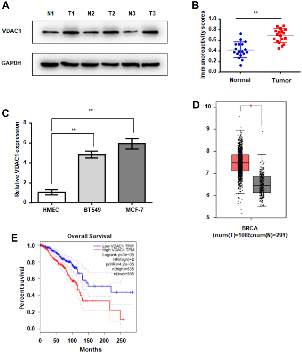 VDAC1 is highly expressed in breast cancer. (A, B) Analysis of VDAC1 expression in 18 breast cancer tissues and adjacent paired normal breast tissue samples. Representative western blotting images of VDAC1 levels in three breast cancer tissues and three normal breast tissues (A). VDAC1 and GAPDH protein levels were determined using ImageJ (B). (C) RT-qPCR was used to detect the mRNA expression of VDAC1 in normal breast cells and breast cancer cells. (D) Expression of VDAC1 in normal tissues and breast cancer tissues from the TCGA database. (E) Kaplan-Meier survival analysis of breast patients with positive or negative VDAC1 expression. The data are presented as the mean ± S.D. *P 